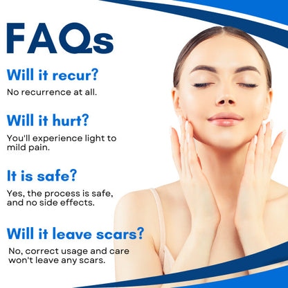 Official Store | Bikenda® Skin Tag Treatment Pen✅Just once a week, visible changes in 7 days🔥