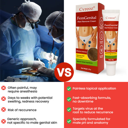 19 Pieces LEFT!!.. Cvreoz® FemGenital Wart Remover Cream ✅ 70% Off! Ends in 10 Minutes!
