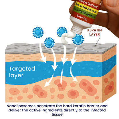 19 Pieces LEFT!!.. Cvreoz® FemGenital Wart Remover Cream ✅ 70% Off! Ends in 10 Minutes!