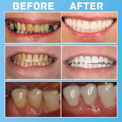 Limited Stock Left!! Cvreoz® All-in-1 Oral Cure Tablet - 👩‍⚕️ Recommended by Experts! 🔥 30-Days Money-Back Guarantee! 💰