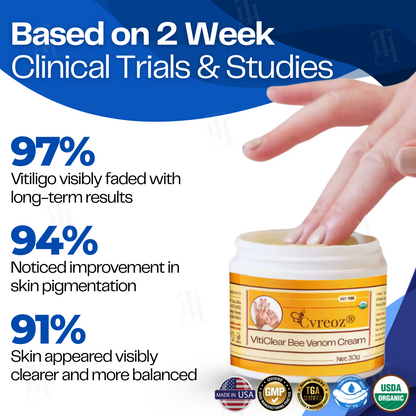 21 Pieces LEFT!!.. Cvreoz® VitiClear Bee Venom Cream